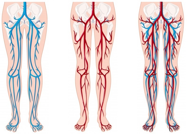 Deep vein thrombosis penis