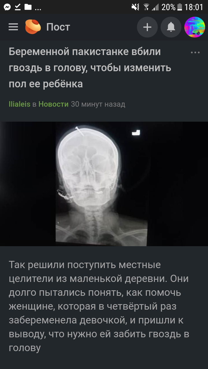 Беременной пакистанке вбили гвоздь в голову, чтобы изменить пол ее ребёнка  | Пикабу