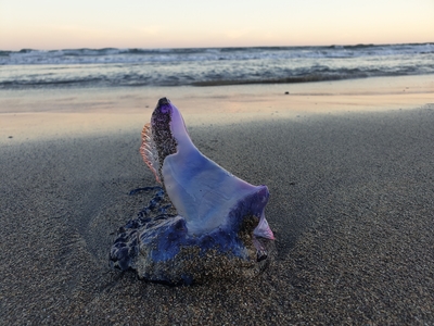 Ожоги от португальского кораблика фото