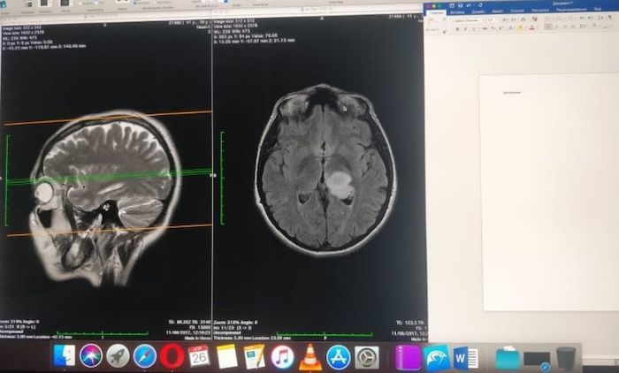 All doctors face this problem. Why Radiologists, Structural Engineers, and Electrical Engineers Need an UltraWide Monitor - 