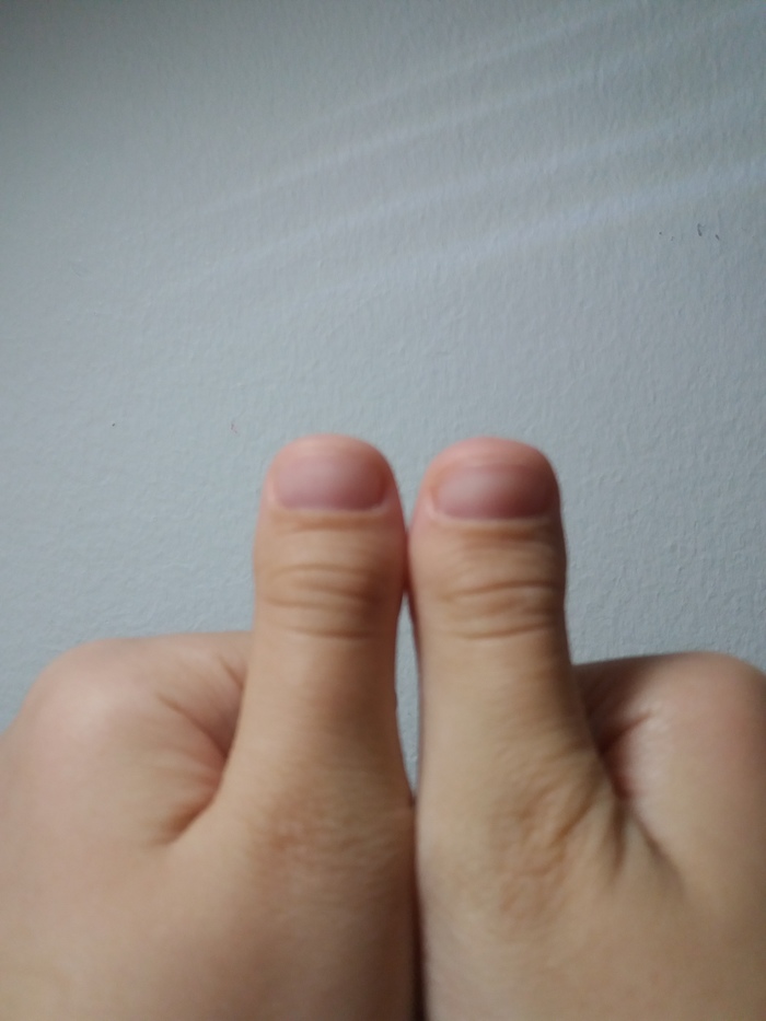 What should I do, I have wide fingers because of this, I constantly suffer from ridicule from classmates. Please tell me what should I do? - My, Fingers, Nails