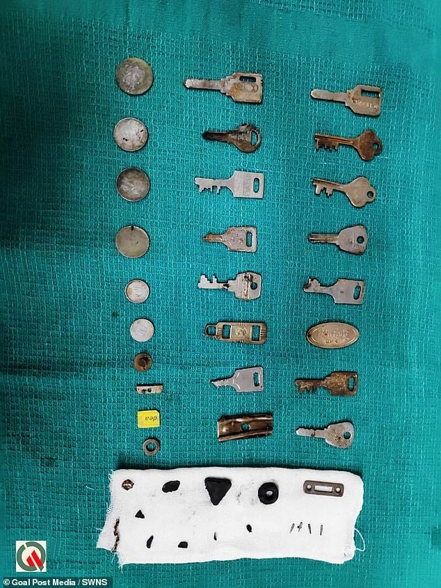 Surgeons remove 38 metal objects from man - Surgery, Oddities, India, From the network