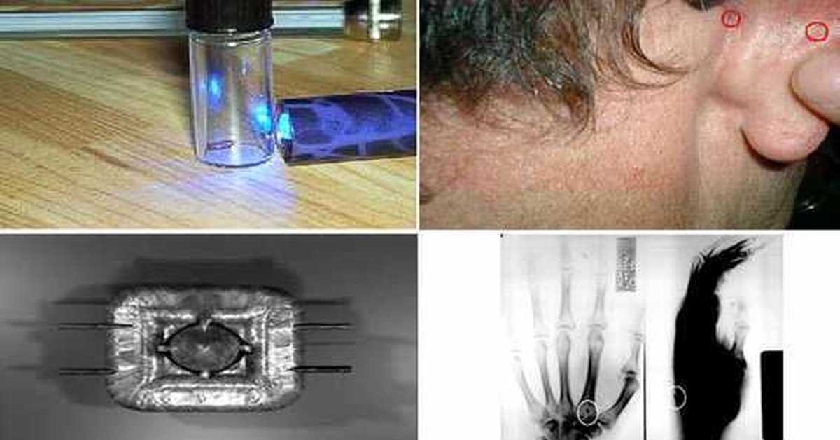 Импланты | Пикабу