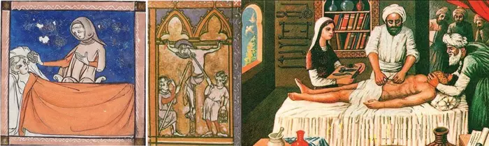 История анестезии: от белены до винишка Медицина, Наука, История, Scientaevulgaris, Длиннопост