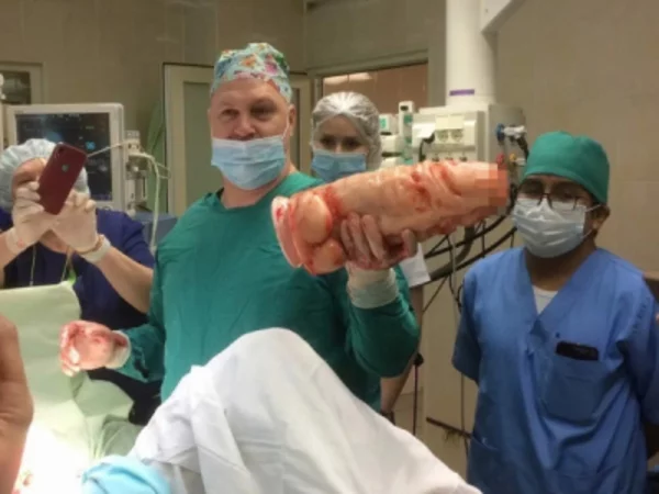 In St. Petersburg, surgeons saved a man from a giant phallus - Penis, Operation, Saint Petersburg, The medicine, Ethics