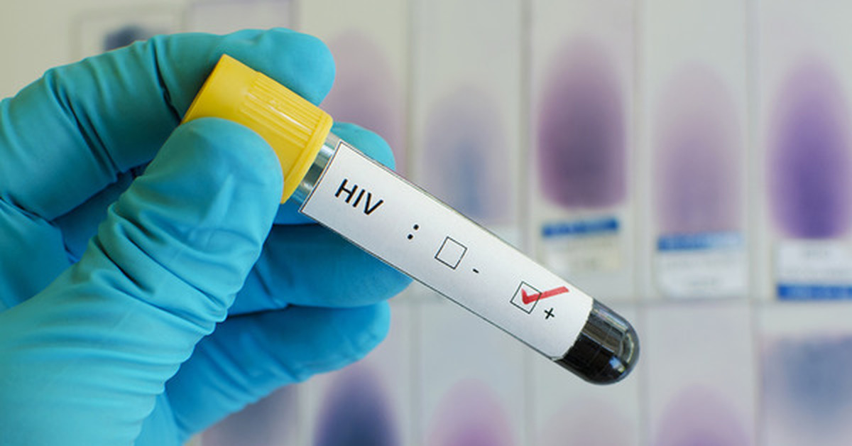 Пробирка на вич. Пробирка на вич. Как отмыть эритроциты для лабораторной диагностики. Забор биоматериала для исследования. Пробирка на вич.