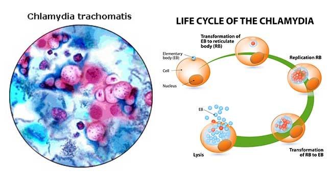 Such terrible chlamydia - Chlamydia, Chlamydia, The medicine, STDs, Gynecology, Health, Longpost