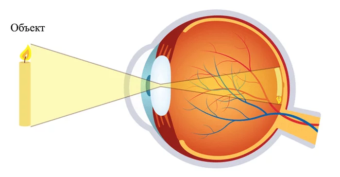 Laser vision correction - Ophthalmology, Eyes, Laser correction, Operation, Longpost