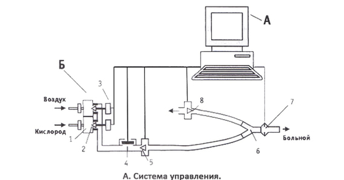 Контур подключение. Подключение аппарата ИВЛ схема. Принципиальная схема ИВЛ. Принципиальная схема аппарата ИВЛ. Строение аппарата ИВЛ.