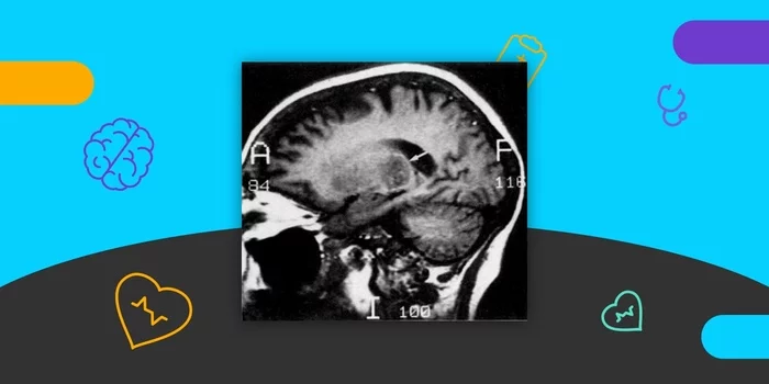 Краткая история медицинской визуализации: от рентгеновского снимка до искусственного интеллекта история медицины,медицина