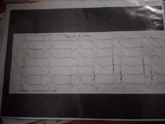 Hello everyone - ECG, Cardio