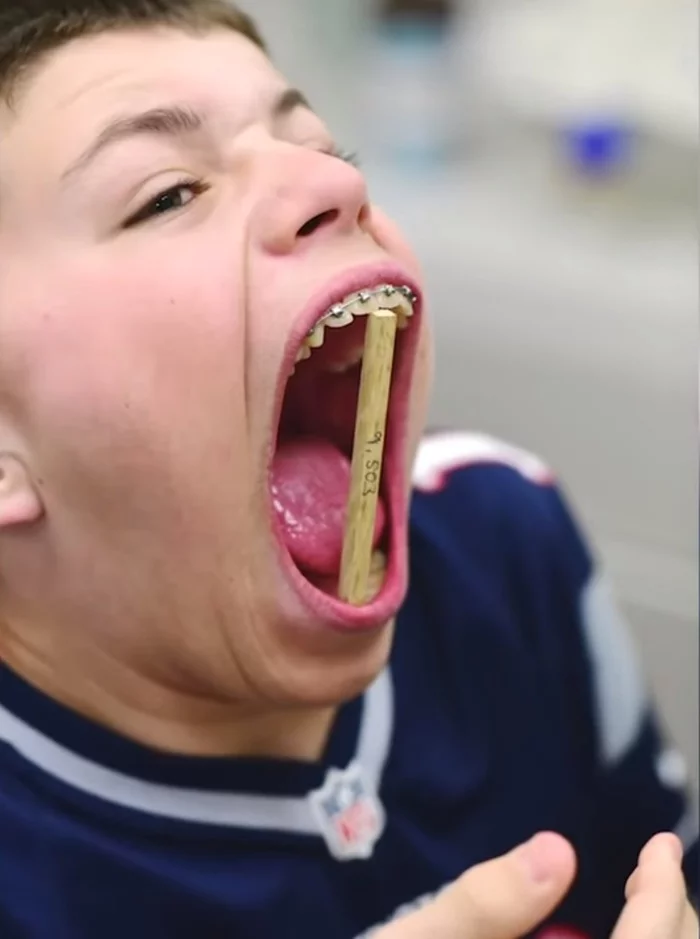 The world's largest mouth - Unusual, Mouth, Teenagers, Record, Longpost