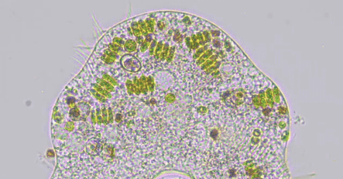 Ciliate, you're just space - Ciliates, Microscope, GIF