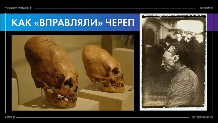 We adjust the stomach, restore vision and micromobility of the brain: why is osteopathy not pleasing to science? Part 1 - My, Anthropogenesis ru, Scientists against myths, The science, Nauchpop, Osteopathy, The medicine, Video, Longpost