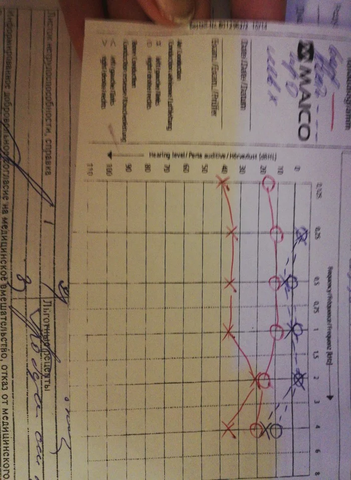 Please help me understand what is wrong with me! I have been suffering from hearing loss for a month, treatment is not helping. - Ears, Disease, Help, Advice, Otitis, Vessels, Doctors need help, Longpost, ENT-Doctors