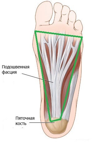 Патология стопы для всех - Травматология, Медицина, Стопы, Длиннопост