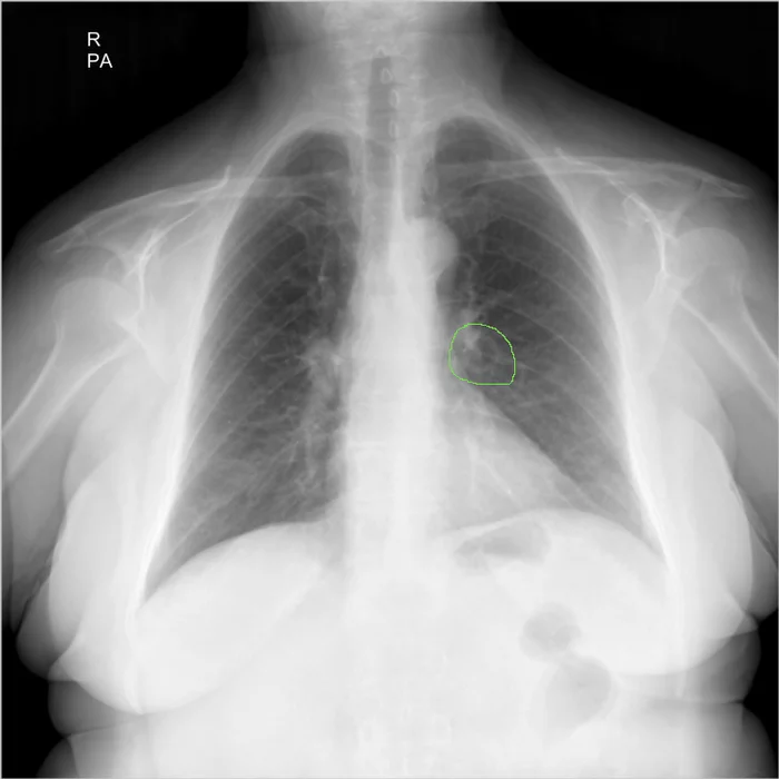 I ask the medical league for help in deciphering the x-ray image - My, The medicine, X-ray, Longpost, Help