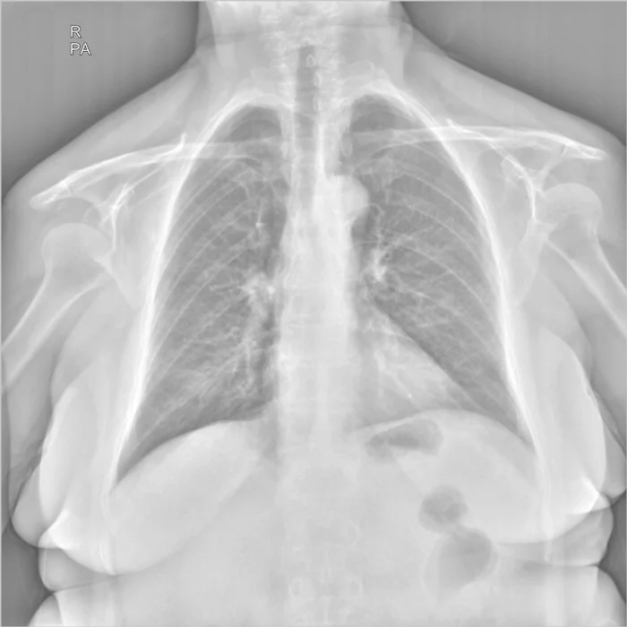 I ask the medical league for help in deciphering the x-ray image - My, The medicine, X-ray, Longpost, Help
