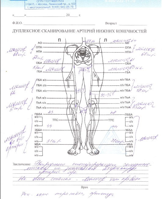 Протокол узи вен нижних конечностей
