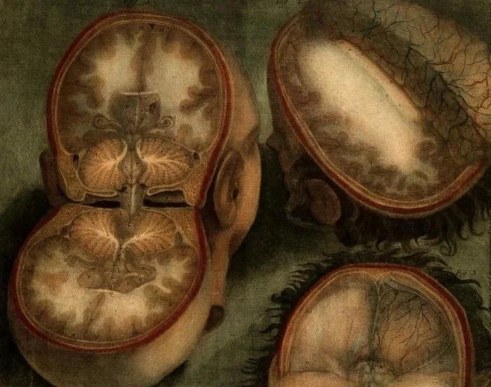 Tomography of the 18th century - Doctors, Interesting