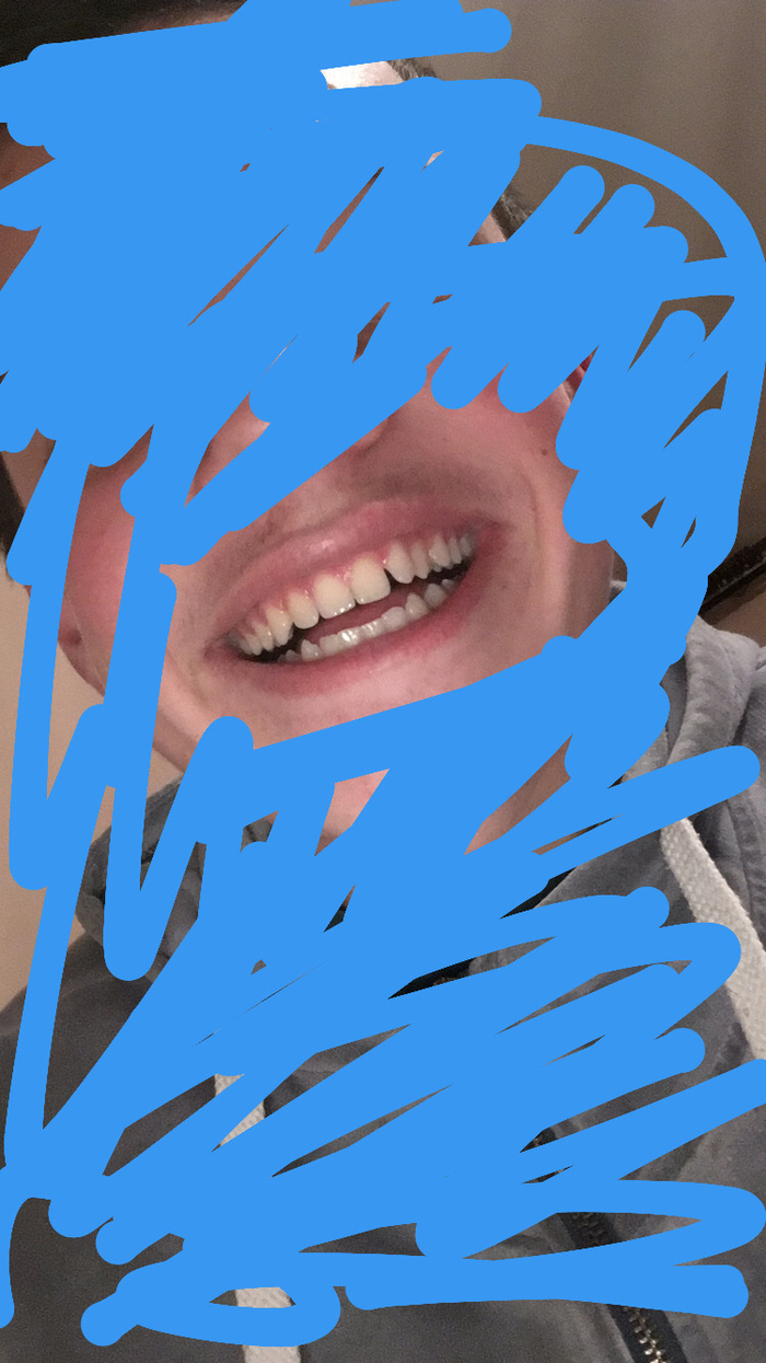 Скажете пожалуйста очень кривые зубы ? Уже многих спрашивал , но они только воду в уши льют . Оцените от 1 до 10. Буду благодарен