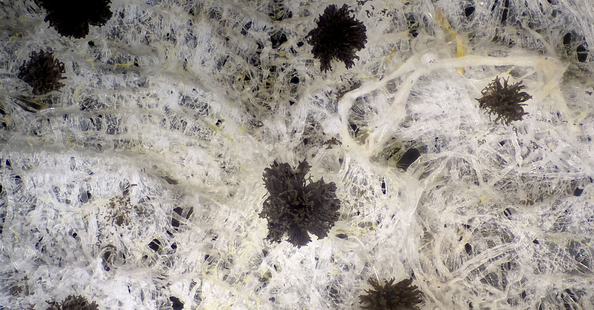 Белая плесень вид. Волосатик плесень. Плесень в микроскопе. Плесневые грибы под микроскопом. Черная плесень под микроскопом.