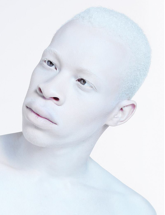 Винтажные фотографии людей-альбиносов