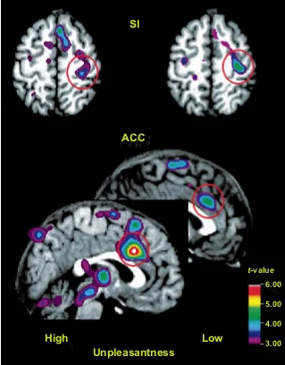 Hypnosis and neuroanotomy - Hypnosis, Psychology, Longpost