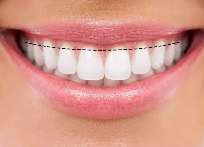 Post #7549774 - My, Braces, Dentistry, Orthodontics, Orthodontist, Dentist, Aesthetics, The medicine, Longpost