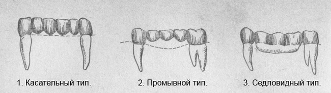 Professional oral hygiene. Part I - My, Dentist, Dentistry, Doctors, Teeth, Dental implantation, Oral hygiene, The medicine, Doctor, Mat, Longpost