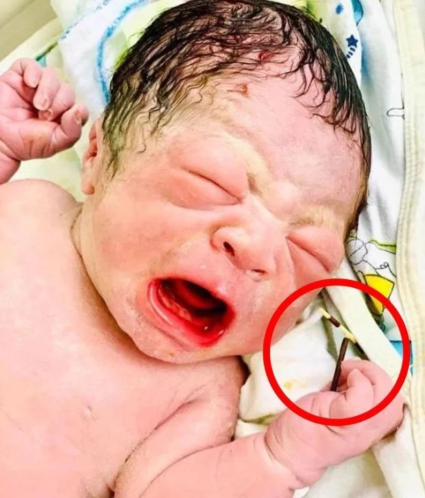 Not only did he win, but he also took trophies! - Vietnam, news, Newborn, Children, Longpost, Intrauterine device, Childbirth