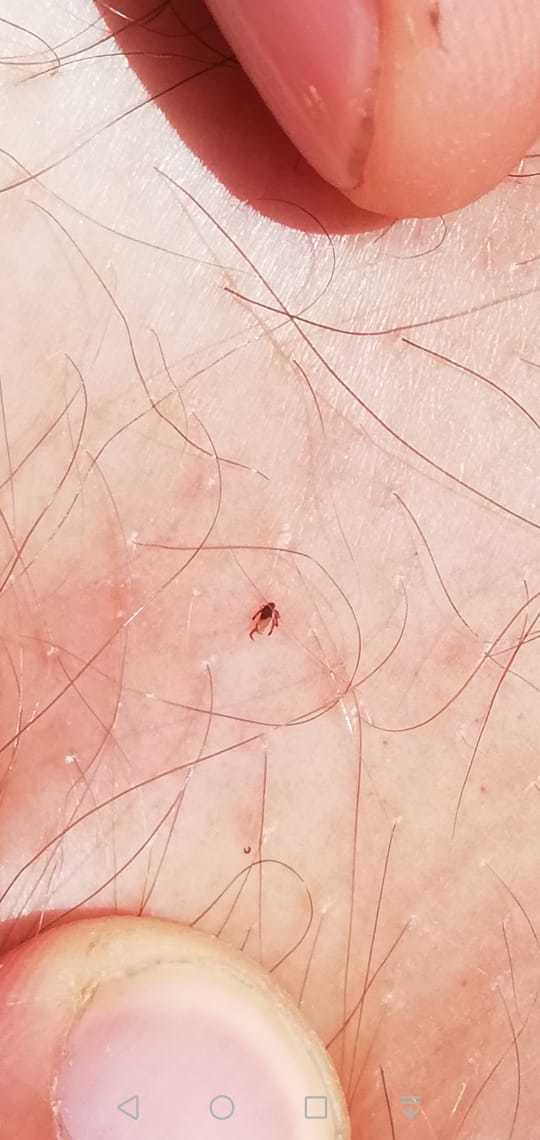 Did you bite the tick or not? - My, Mite, Tick-borne encephalitis, Tick-borne borreliosis, Protection against ticks