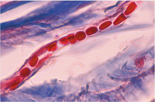 Blood under a microscope. Part 1. Red blood cells, neutrophils, basophils and eosinophils - My, The medicine, Histology, Microscope, Informative, Longpost