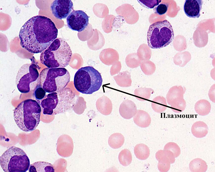 Лимфоциты фото под микроскопом