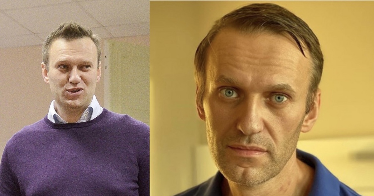 Второй очевидно. Навальный худой.