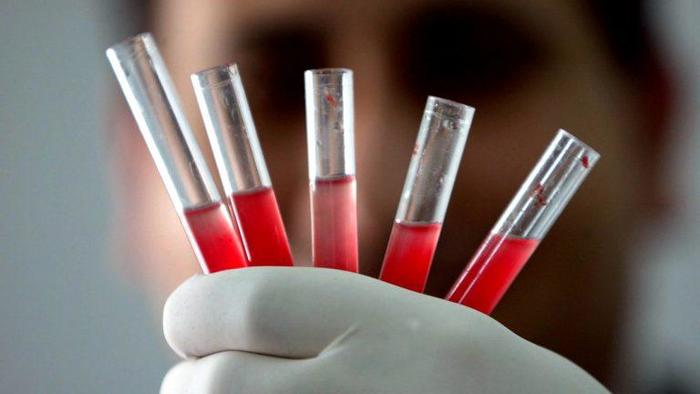 Сегодня Я Узнал Reddit, Сегодня я узнал, Интересное, Перевод, Жизнь, Видео, Длиннопост Сегодня Я Узнал Reddit, Сегодня я узнал, Интересное, Перевод, Жизнь, Видео, Длиннопост