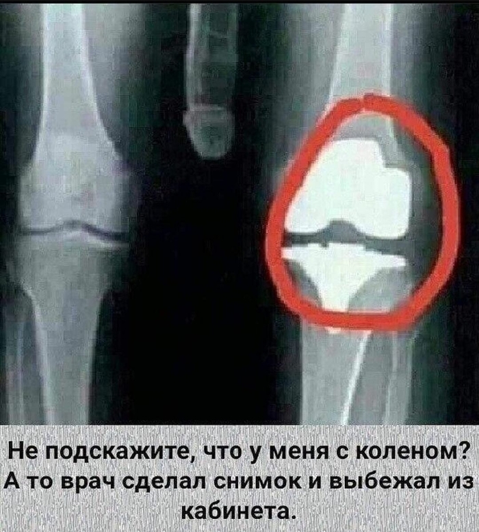 Колени пикабушника | Пикабу