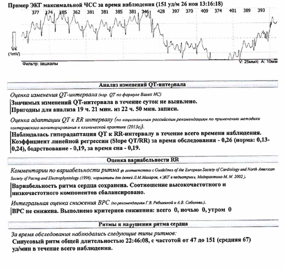 Экстрасистолия (нужен совет) - Моё, Экстрасистолия, Сердце, Без рейтинга, Длиннопост, Нужна помощь врачей