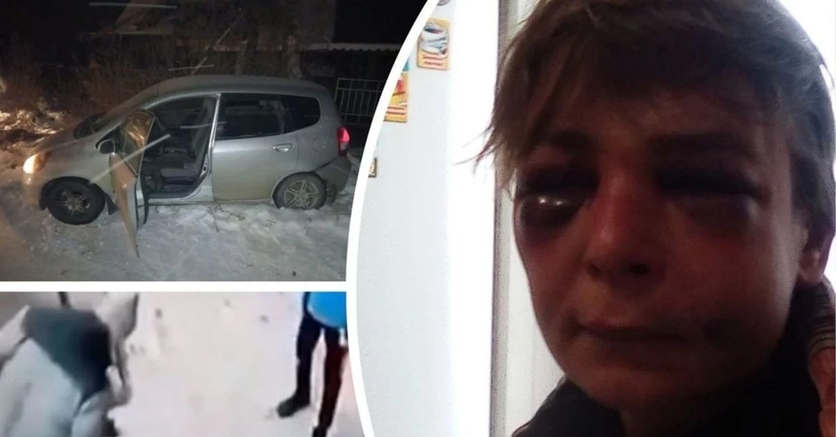 Мальчик после. Новосибирская таксистка, избитая подростками. Избиение таксистки в Новосибирске.