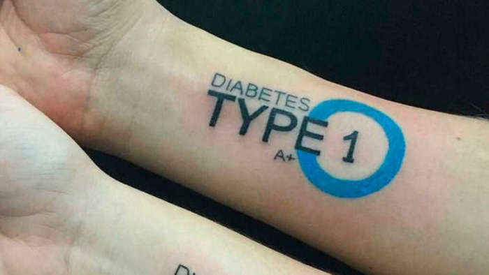 Tattoos for people with diabetes - Tattoo, Diabetes, The medicine, Innovations, Technologies, Kiev, Longpost