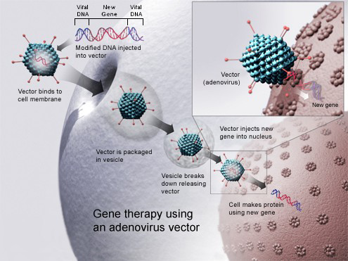 Sputnik V vaccination and gene therapy - find five differences - My, Vaccine, Satellite V, Coronavirus, The science, The medicine, Genetics, Virus, Health, Longpost