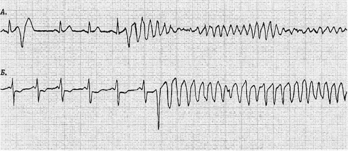 Physiology. Myths and misconceptions #7: clinical death (cardiac arrest) - Resuscitation, Cardiac arrest, Clinical death