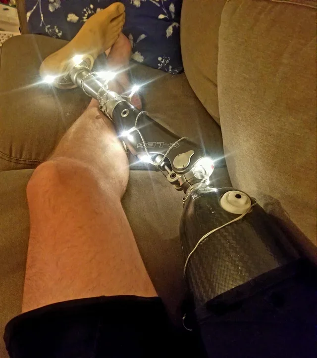 My Sister Thought My Leg Needed More Holiday Cheer - Reddit, Prosthesis, Holidays, Garland