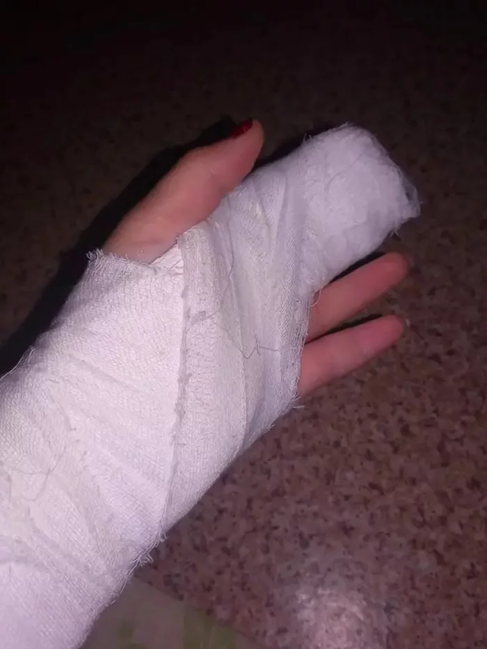 Played with pussy - lost - Injury, Fracture, Pun