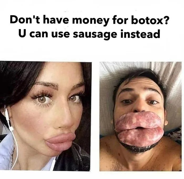 Когда нет денег на ботокс