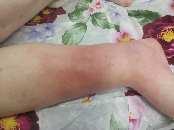 Please tell me what this is and which specialist to contact - My, Doctors, The patients, No rating