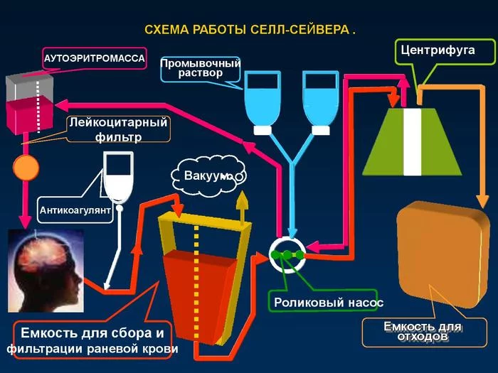 Alternatives (4) Cell Saver - Blood, Donor, Just, Longpost