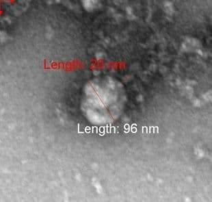 First photo of the UK strain of COVID-19 - My, news, The science, Coronavirus, Pandemic, Epidemic, Microfilming