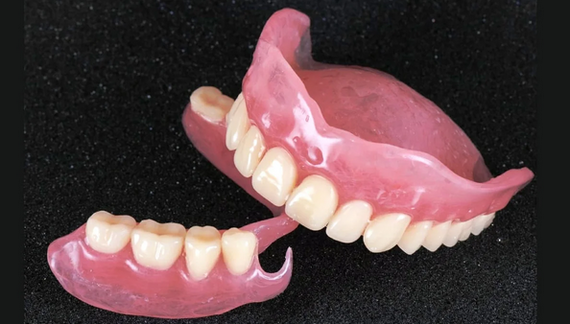 Nylon dentures: who are they suitable for and how much do they cost? - False jaw, Light, Longpost