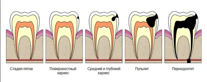 Почему у стоматологов и тренеров нету фиксированного прайса, или подробный ответ на пост не скажу - Моё, Фитнес, Фитнес-Клуб, Фитнес-Тренер, Клиенты, Пациенты, Стоматология, Цены, Крик души